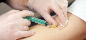 Escleroterapia combinada